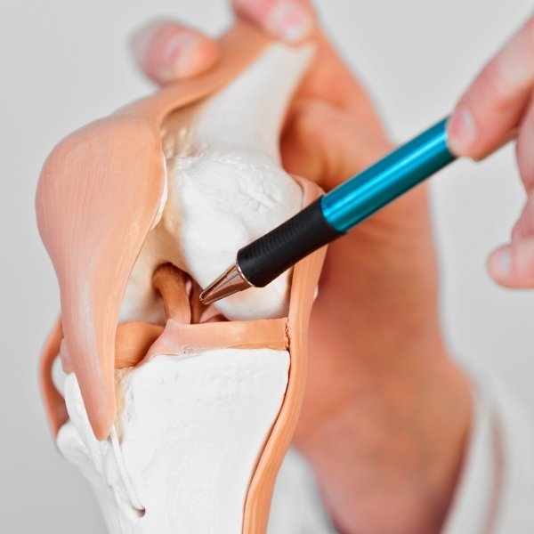 Ligamento Cruzado Anterior